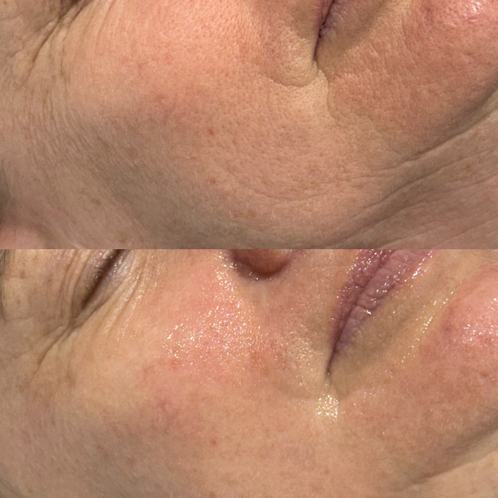 The Anti-Ageing Reset Duo